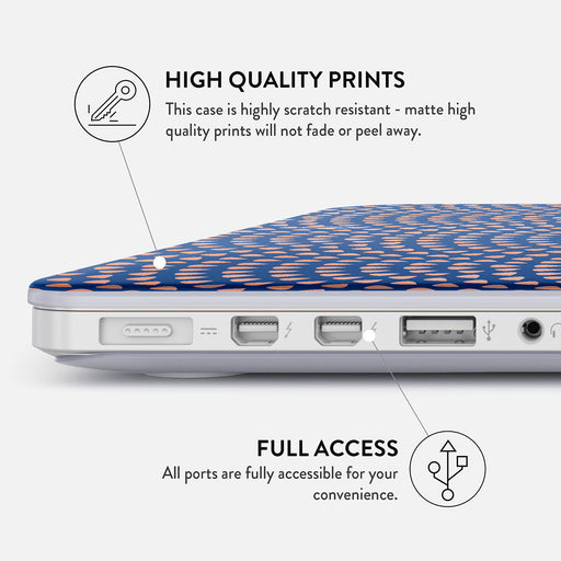 Azure Waters - Macbook Case 20