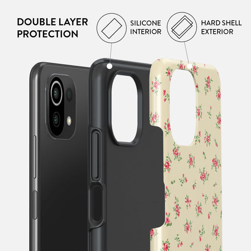 Sundress - Xiaomi Mi 11 Lite 4G / 5G Case 2