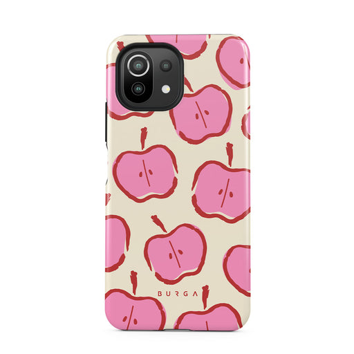 Bon Appétit - Xiaomi Mi 11 Lite 4G / 5G Case 1