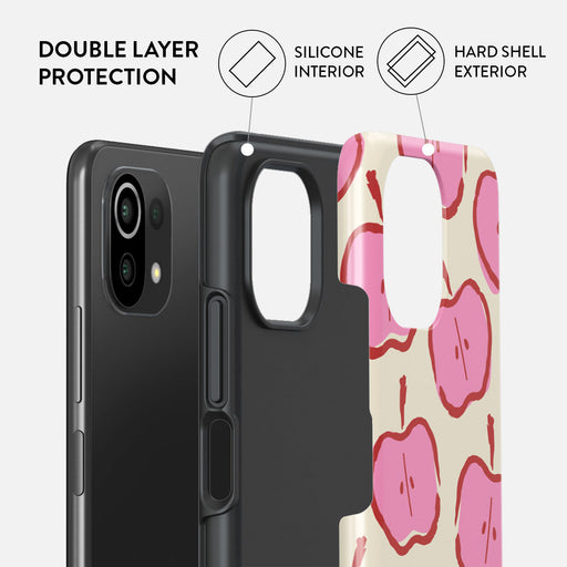 Bon Appétit - Xiaomi Mi 11 Lite 4G / 5G Case 2
