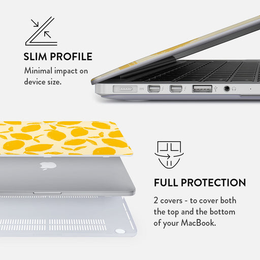 Lemon Tart - Macbook Case 18