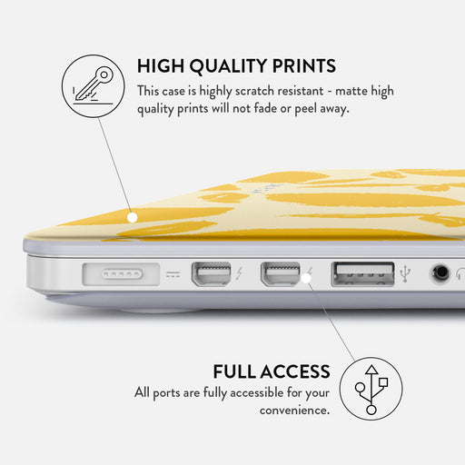 Lemon Tart - Macbook Case 20