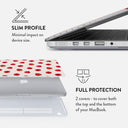 Summer Forever - Macbook Case 18