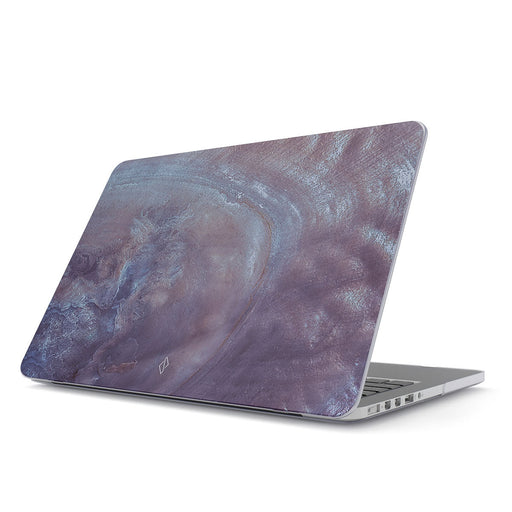 Side Effect - Macbook Case 1