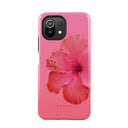 Island Girl - Xiaomi 11 Lite 5G NE Case 1