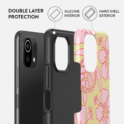 Tan Break - Xiaomi 11 Lite 5G NE Case 2