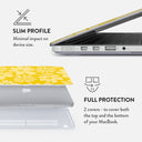 Core Memory - Macbook Case 18