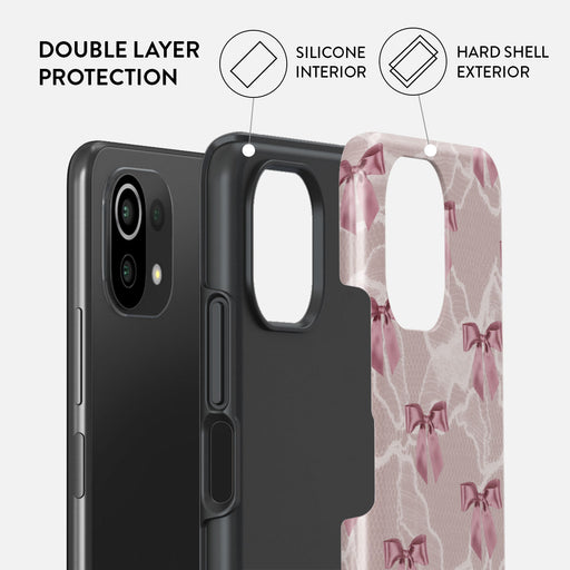 Ballerina - Xiaomi Mi 11 Lite 4G / 5G Case 2