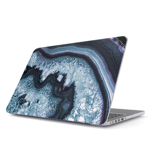 Frozen Lake - Macbook Case 1
