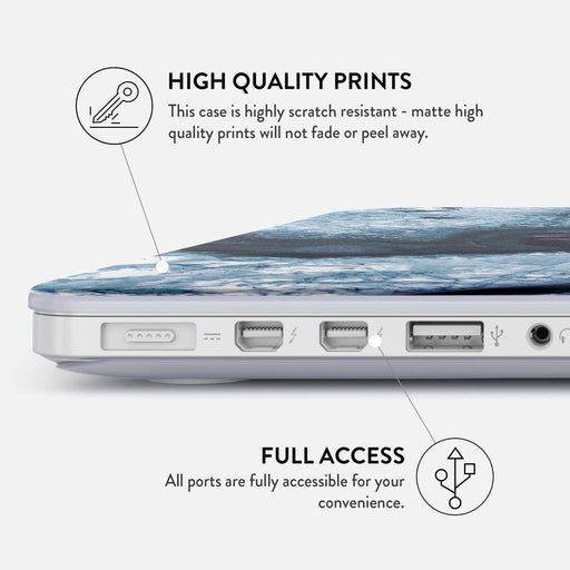 Frozen Lake - Macbook Case 20