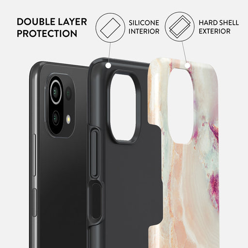 Berry Sorbet - Girly Xiaomi 11 Lite 5G NE Case 2