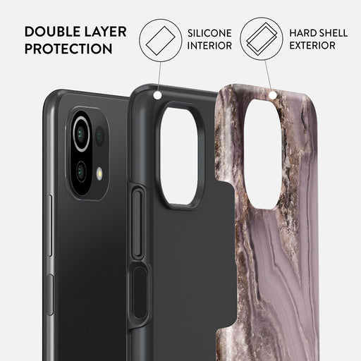 Golden Taupe - Fashion Xiaomi 11 Lite 5G NE Case 2